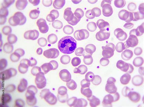 Fotografia Do Stock Neutrophil Cell White Blood Cell In Peripheral