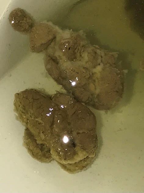 Fuzzy Poop Hi Ive Recently Experienced Some Ibs Network