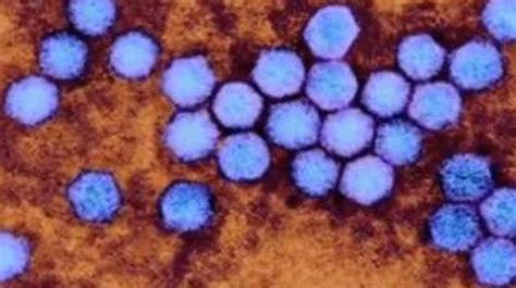 enterovirus link probed in deaths of girl 3 others