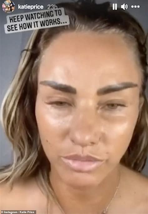Katie Price Goes Makeup Free To Show Off The Results Of Her Dramatic Lip And Eye Lifts In Beauty