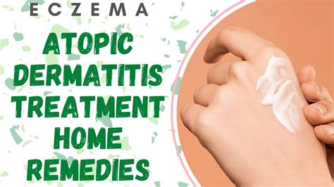 Atopic Dermatitis Treatment Home Remedies Youtube