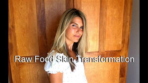 Raw Food Skin Before And After 801010 Transformation Photos Youtube