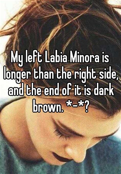 my left labia minora is longer than the right side and the end of it is dark brown