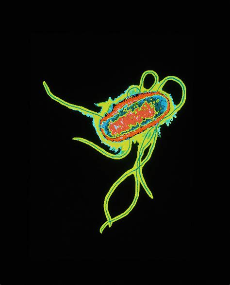 Coloured Tem Of Escherichia Coli Bacteria Photograph By Dr Linda