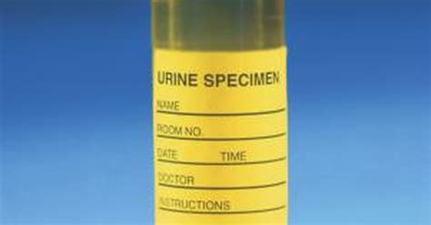 Extremely High Protein in Urine