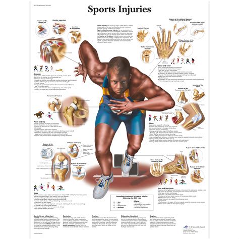 Sports Injuries Chart 1001494 Vr1188l 근육 3b Scientific
