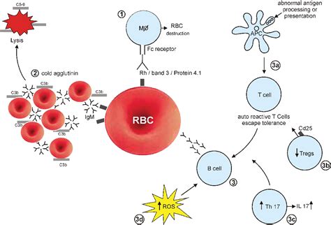 Autoimmune Hemolytic Anemia Current Understanding Of Pathophysiology