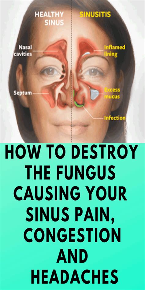 Quick Way To Drain Sinuses Just For Guide