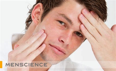 8 Steps To Stop Stress Related Acne Breakouts Menscience