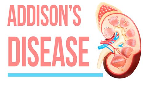 Addisons Disease Symptoms Diagnosis And Treatment Healthsoul
