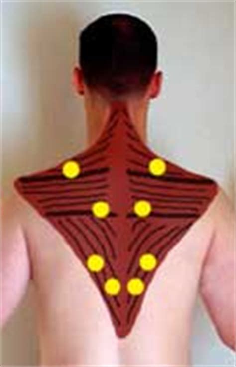 Moreover, a person may experience stiffness and this condition causes morning aching and stiffness in the shoulders, upper arms, hips, thighs, and back of the neck. Trapezius Trigger Points - Self Massage