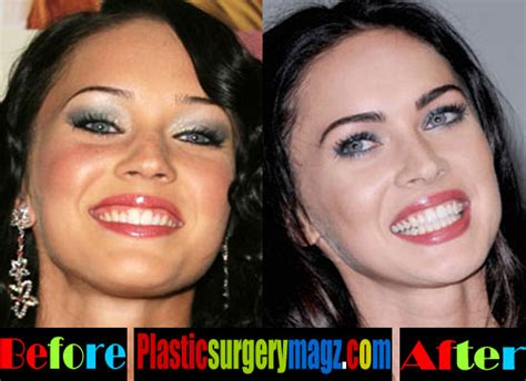 It involves the dentist cutting a small hole in the gum, which allows the tooth to erupt. Megan Fox Before and After Plastic Surgery | Megan Fox ...