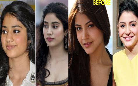 Shocking Pictures Of Bollywood Actresses Before And After Plastic Surgery