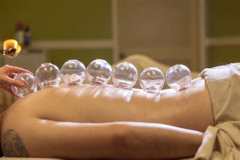 Some people also get needle cupping, in which the therapist first inserts acupuncture needles and then puts cups over them. Cupping Therapy in San Diego & La Mesa | Root & Soul