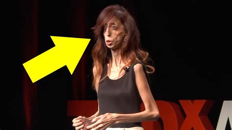 she was once called the world s ugliest woman—now she s living your dreams youtube
