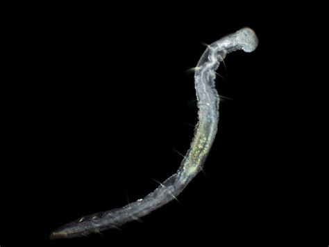 Aeolosoma Worm Under Microscope Worm Under Microscope Worms Microscope