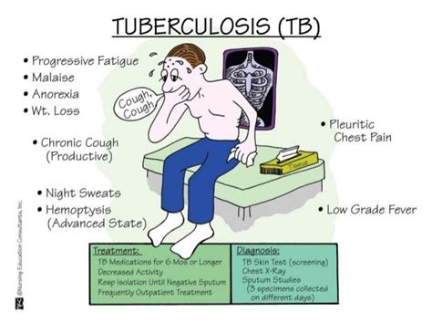 Clinical Featuresdiagnosis And Treatment Of Tuberculosis