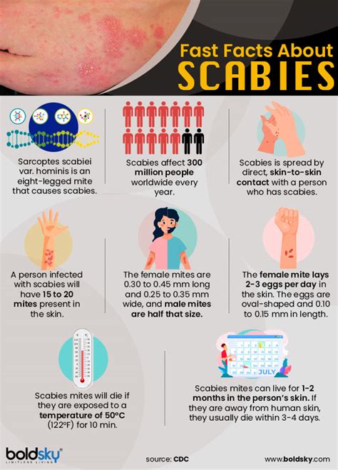 Scabies Causes Symptoms Treatment Pictures Images