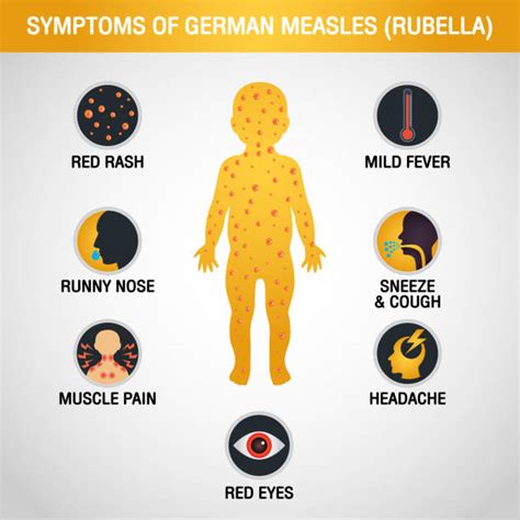Measles Sign Illustrations Royalty Free Vector Graphics And Clip Art