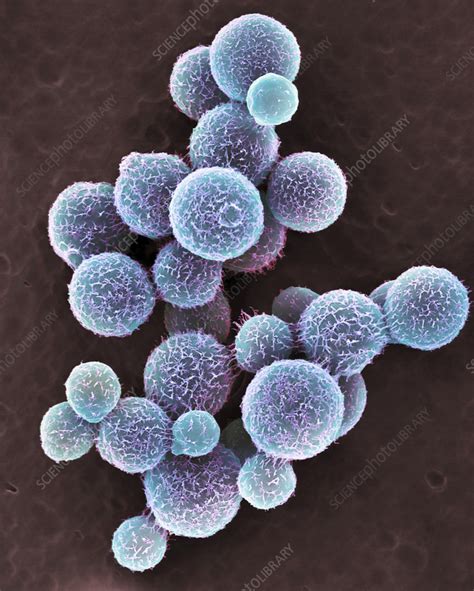 Cryptococcus Neoformans Yeast Sem Stock Image C0563901 Science