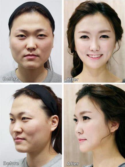 Wajah Asli Orang Korea Tanpa Operasi Plastik