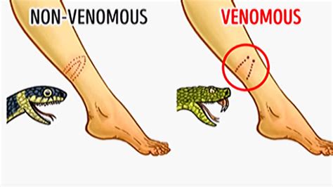 Venomous Snake Vs Non Venomous Snake How To Identify Youtube