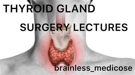 Thyroid Surgery Lecture 5 Developmental Disorders Goiters Aetiology