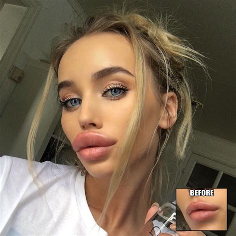 Wax Lips Lip Fillers Bimbo Other Woman Gorgeous Women Enhancement Photoshop Beauty