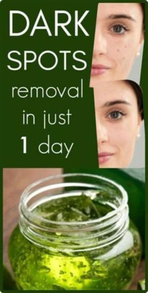 I Got Shocked With The Results Of This Magical Remedy It Removed Dark