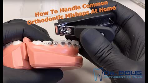 How To Handle Orthodontic Emergencies At Home Youtube