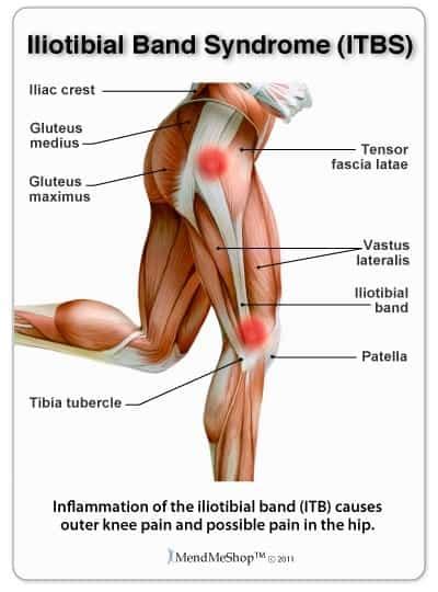 Muscles move by shortening their length, pulling on tendons, and moving bones closer to each other. IT Band Syndrome (ITBS) - Mississauga Chiropractor and ...