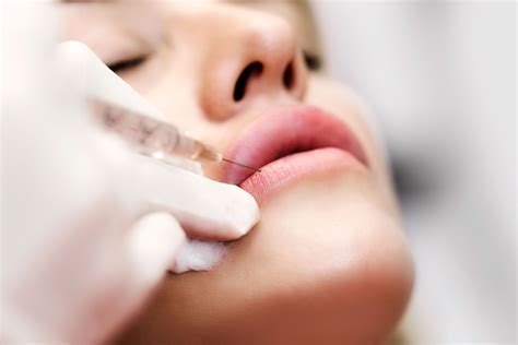 how to get rid of botox in lips