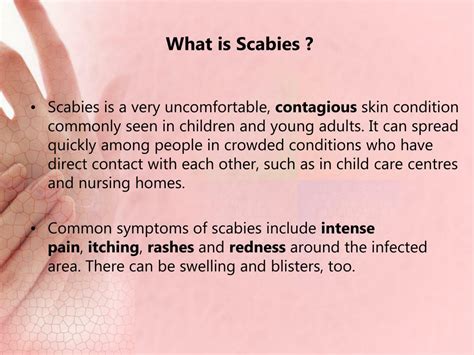 Ppt 5 Home Remedies For Scabies Treatment Powerpoint Presentation