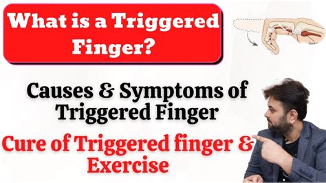 What Is Triggered Finger Causes Symptoms And Homeopathy Treatment Of