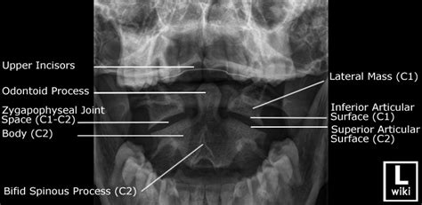 Cervical Spine Radiographic Anatomy Wikiradiography