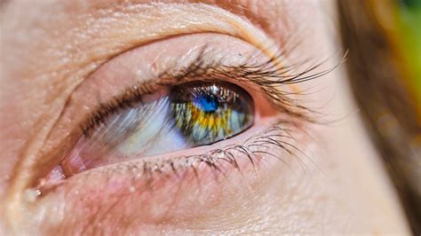 Study Finds Retinal Differences In Patients With Schizophrenia