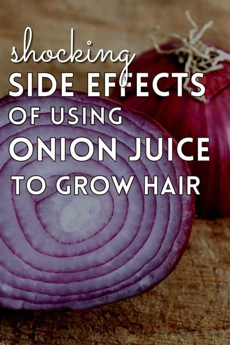 Shocking Onion Juice For Hair Growth Pros And Cons You Didnt Know
