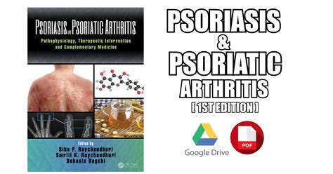 Psoriasis And Psoriatic Arthritis Pdf Free Download Direct Link