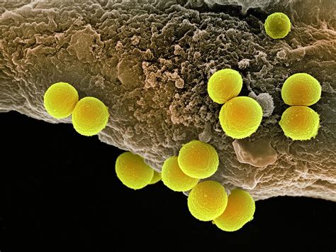 Staphylococcus Aureus Bacteria Sem Photograph By Pixels