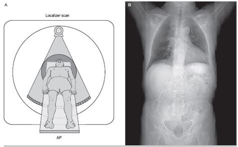 What Is Localizer On Ct Scan Radtechonduty