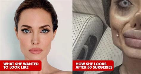 Woman Underwent 50 Surgeries To Look Like Angelina Jolie Heres How