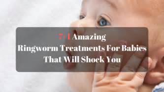 71 Amazing Ringworm Treatments For Babies That Will Shock You