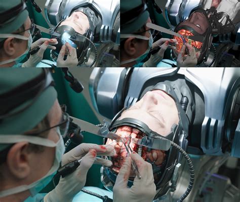 Effects How Are Surgery Scenes Shot In Tvfilm Movies And Tv Stack