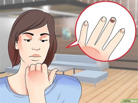 Toenail fungus, also known as onychomycosis, is a type of fungal infection that specifically affects a toenail fungus infection is caused by a group of fungi known as dermatophytes (tinea unguium). Come Sapere se hai una Micosi alle Unghie: 15 Passaggi