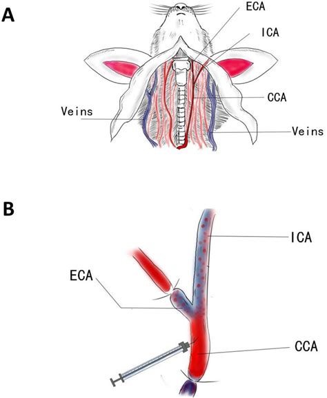 Search strategy and selection criteria. (A) Schematic depicting the mouse neck with vascular ...