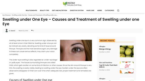 What Causes Swelling Under One Eye Beauty Tips