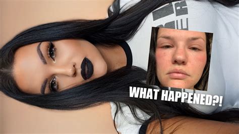 Grwm What Happened To My Face Youtube