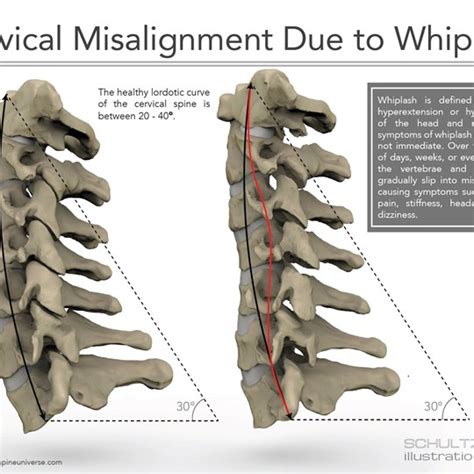 Medical Illustration And Animation Association Of Medical Illustrators