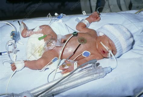 Premature Baby In An Intensive Care Unit Stock Image M8200308
