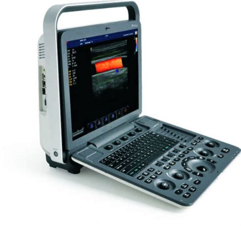 China Sonoscape S8 Exp 3d Portable Color Doppler Ultrasound Scanner